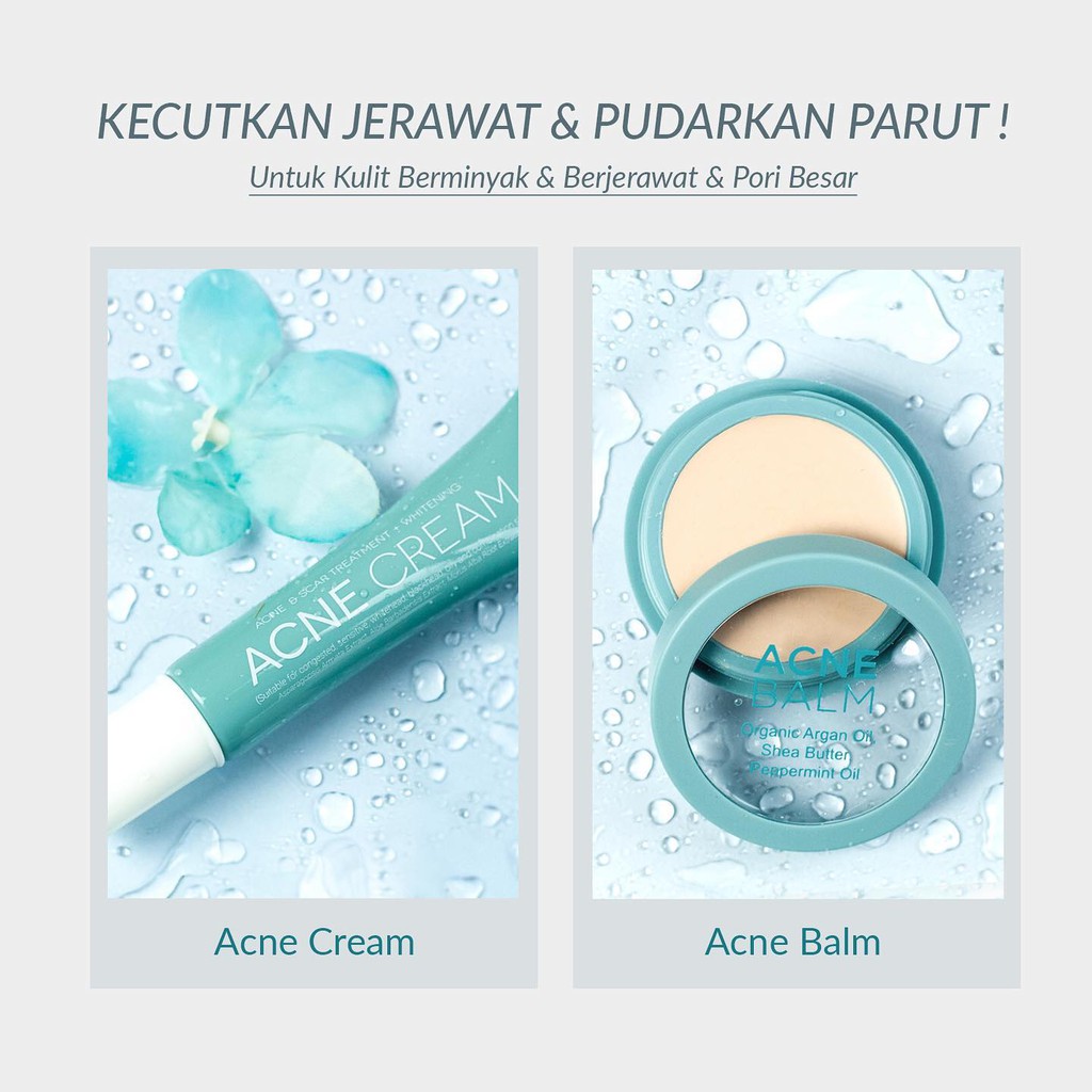 Acne Cream Acne Balm By Sendayu Tinggi | Shopee Malaysia