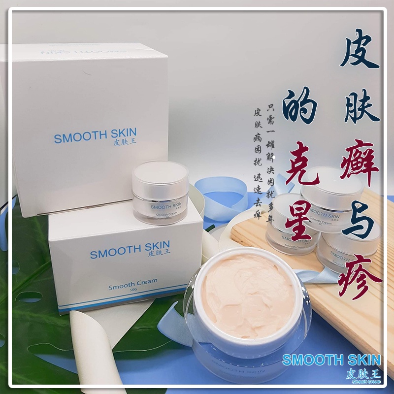 【湿疹/ 牛皮癣/ 富贵手】Smooth Skin皮肤癣药膏无类固醇 Eczema / Psoriasis Cream 【Steroid