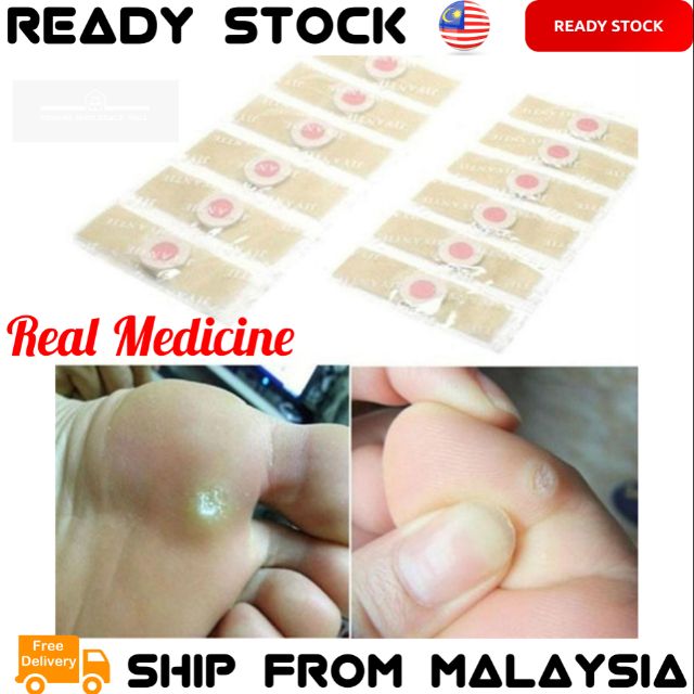 JIYANTIE Paste Foot Corn Plasters [ Remove The Corns ] Paste Clavus