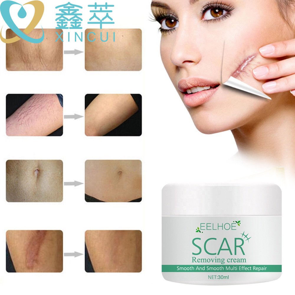 leave no trace EELHOE scar removal cream scar cream acne scar removal ...