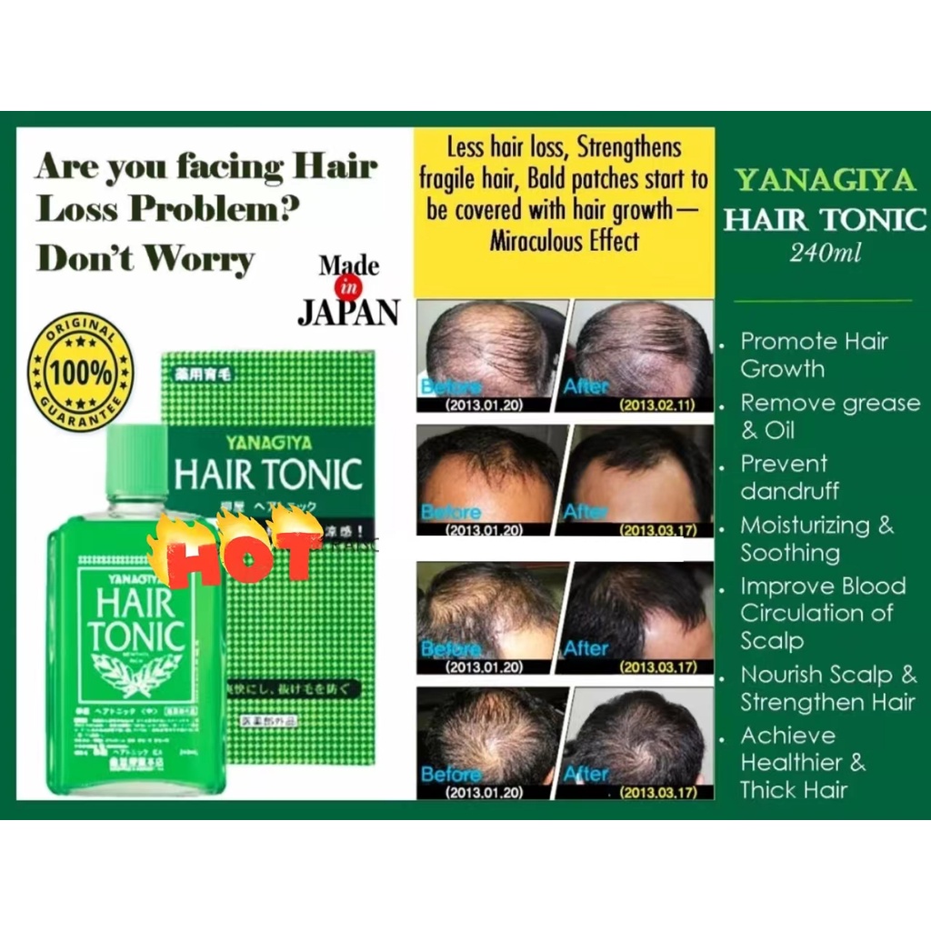 🇲🇾💖Ready Stock Malaysia💖🇲🇾 YANAGIYA Hair Medicated Hair Growth Tonic