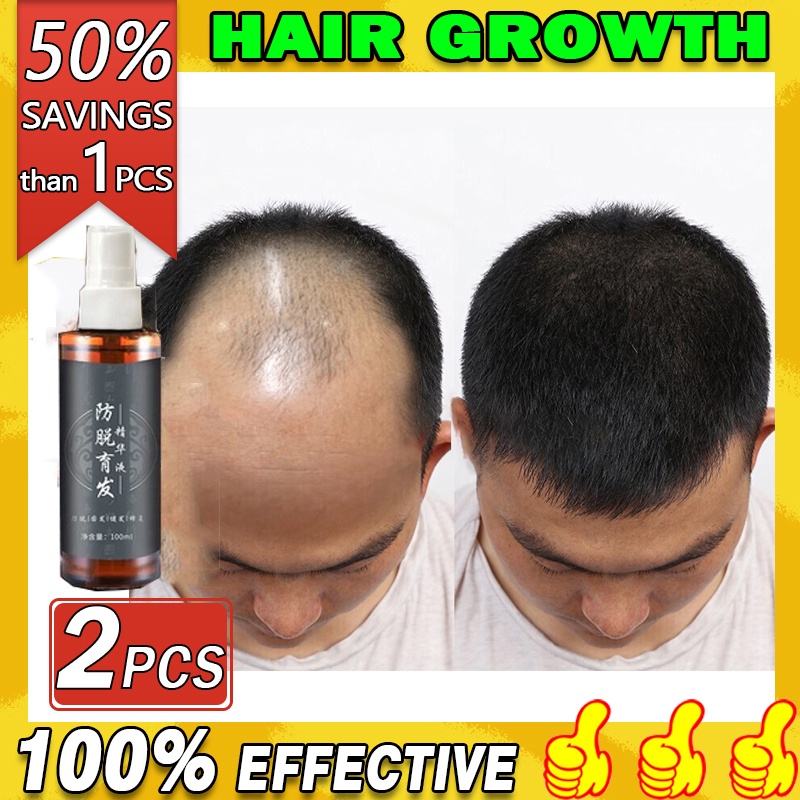 Hair grower spray men and women hair care hair growth spray essence