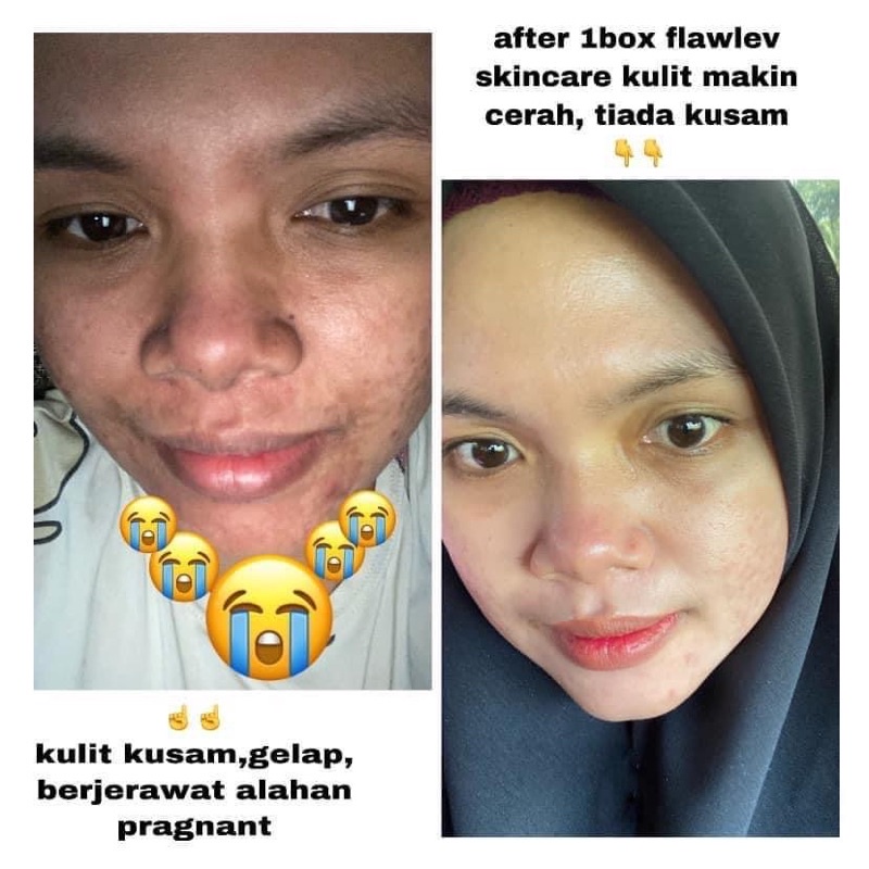 𝗙𝗟𝗢𝗪𝗟𝗘𝗩 𝗦𝗞𝗜𝗡𝗖𝗔𝗥𝗘 :)) | Shopee Malaysia