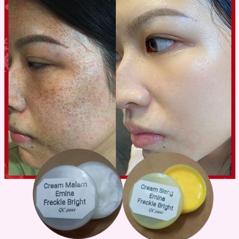 (Krim Siang & Malam) Indonesia Emina Whitening Freckles Jeragat Bekas