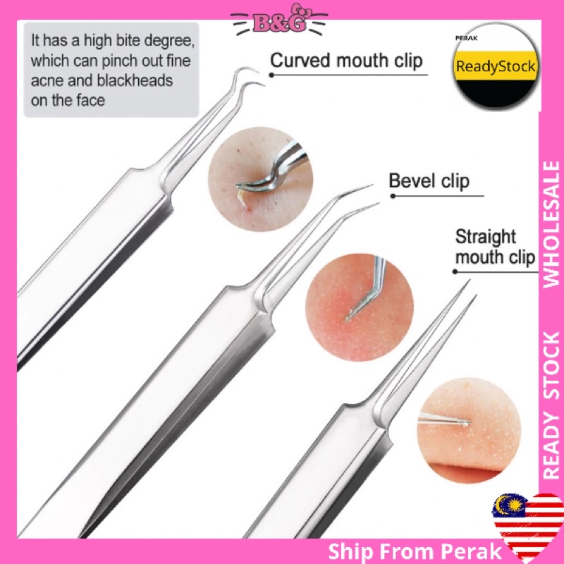 3pcs/Set Pimple Black Head Clip Acne Removal Needle Face Tweezer Flat ...
