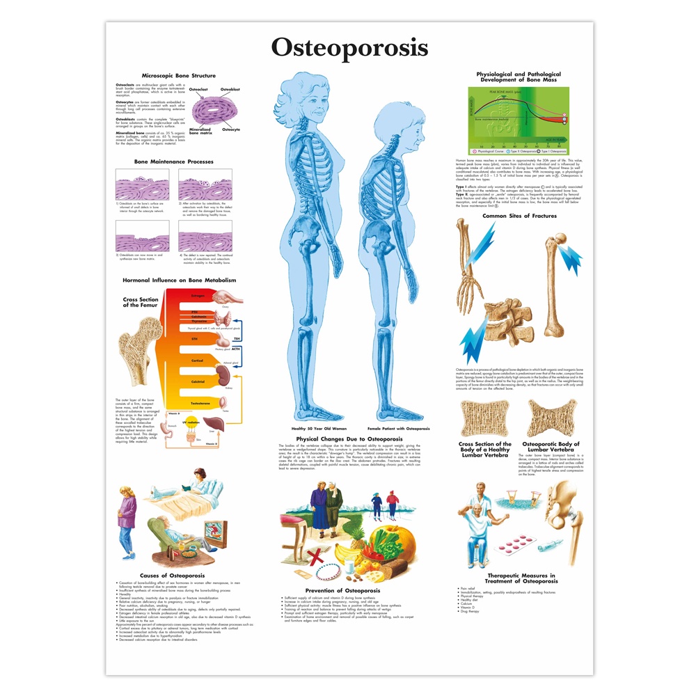 25 kinds of Human Diseases Stroke, Hypertension, Common Cardiac ...