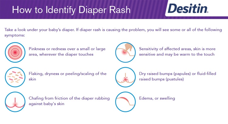 Desitin Maximum Strength Original Diaper Rash Paste Baby Cream/ Daily ...