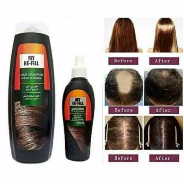 Shampoo RE FILL+ANTI HAIR FALL SPRAY ANTI HAIR Loss Treatment MY WAY