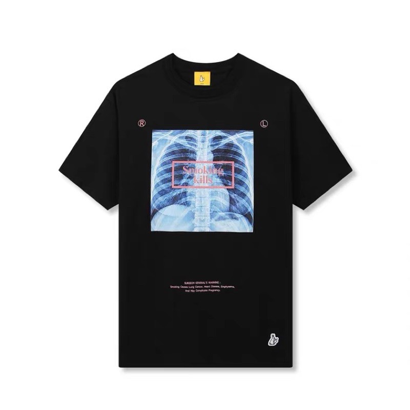 #FR2 JAPAN / Fxxking rabbits X-RAY x Smoking Kills unisex tee/ t-shirt  (pre-order)