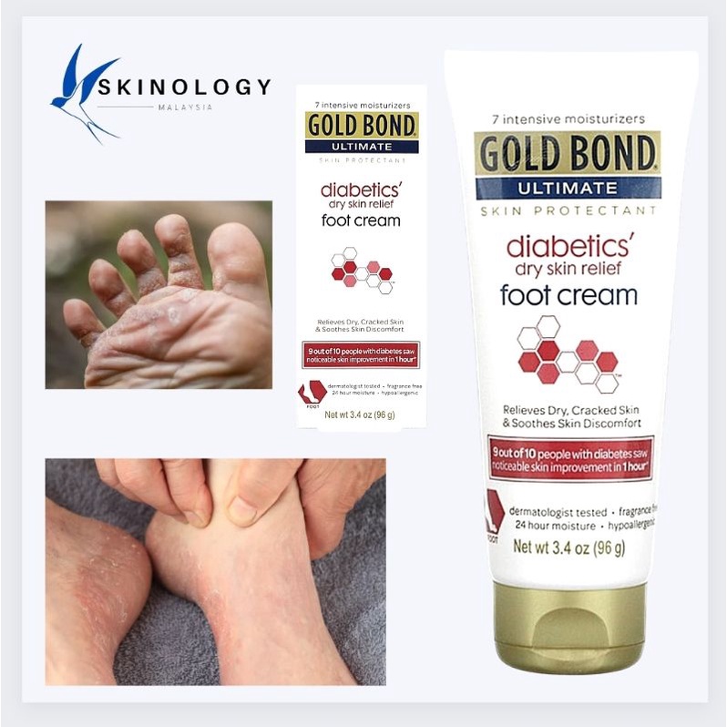 Diabetics dry skin on sale relief foot cream