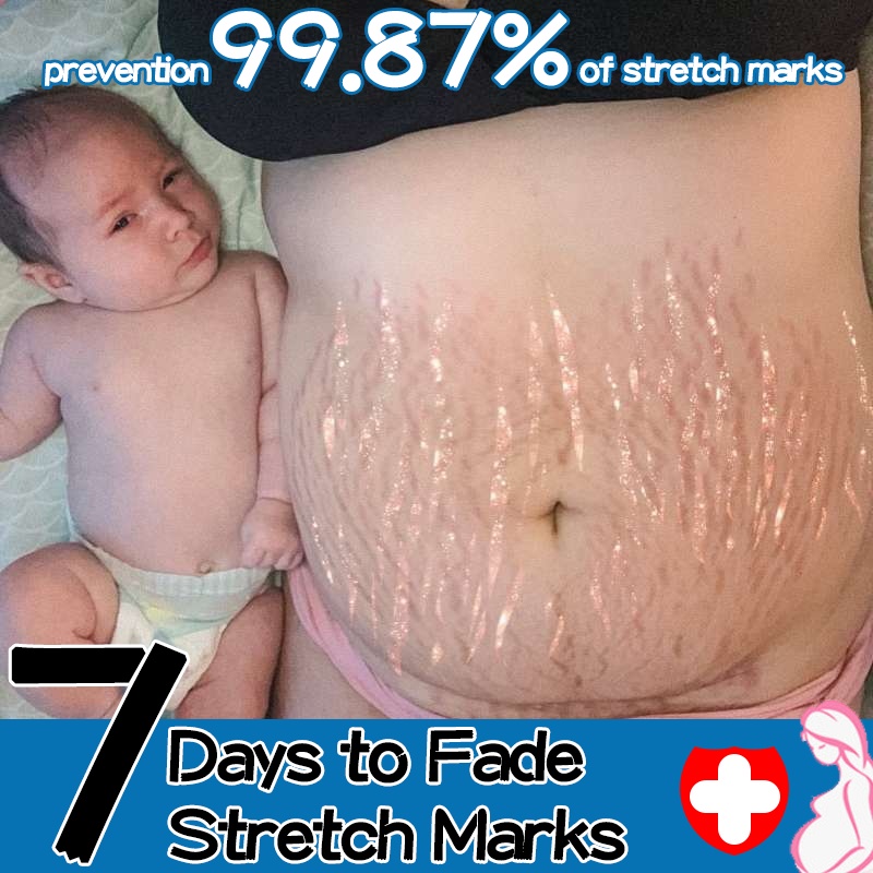 Stretch Mark Cream Scar Repair Cream 60g Halal Safety Remove Breast