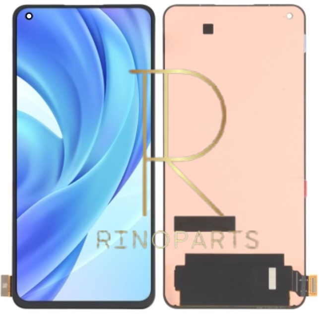 XINYEXIN Custodia Per Xiaomi Mi 11 Lite 4G/5G/5G NE – Cover IMD Con Design Glitter E Marmo, Morbida TPU Antiurto, Bordi Rialzati, Ricarica Wireless, Regalo Donna