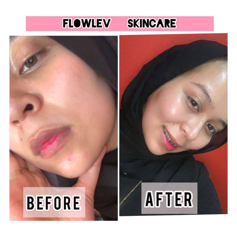 🔥 NEW LOOK 🔥 FLOW'LEV SKINCARE ORIGINAL HQ | Shopee Malaysia