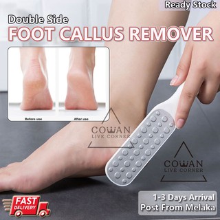 1Pcs Professional Foot Scrubber Files For Callus Remover Hard Skin