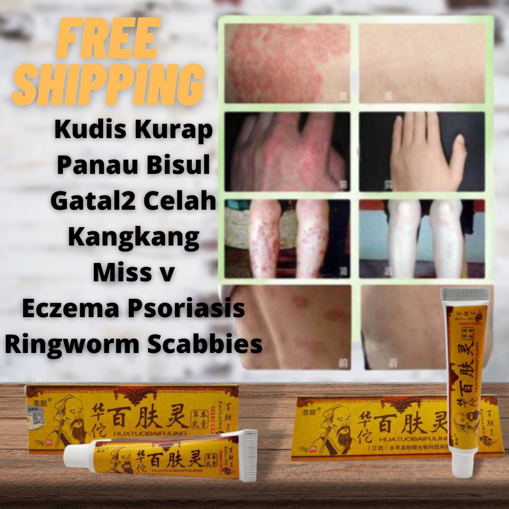 HUATUOBAIFULING Natural Chinese Herbal Medicine Cream Eczema Psoriasis ...