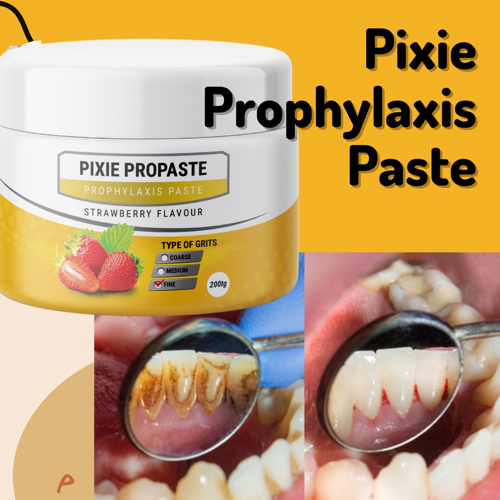 Pixie Dental Prophylaxis Polishing Paste Shopee Malaysia
