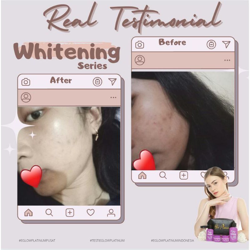 Eglow PLATINUM/CREAM E GLOW PLATINUM/EGLOW PLATINUM bpom/skincare ...