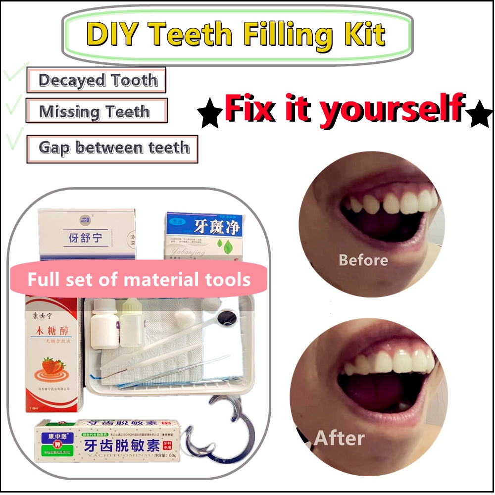 [hot new products] DIY operation to repair decayed teeth, missing teeth ...