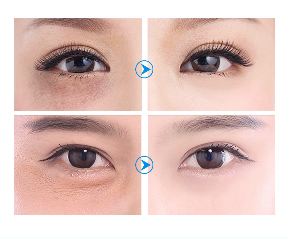 LANBENA Eye Mask Hyaluronic Acid Collagen Eye Patch Gel Masker