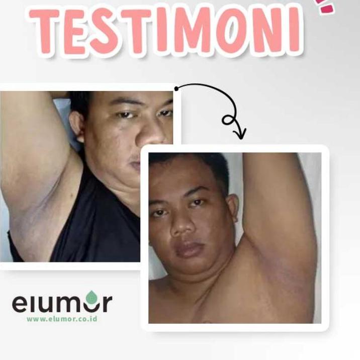 SIKU Hot - ELUMOR OXTER CEAM FORMULA - Whitening CREAM Armpit/Groin ...