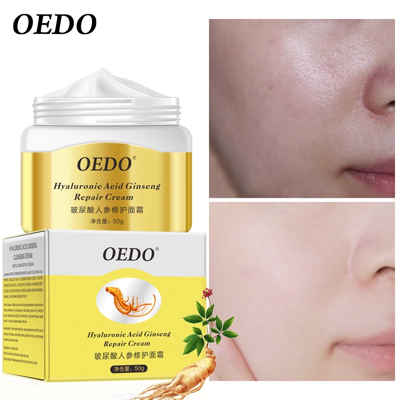 OEDO Hyaluronic Acid Ginseng Repair Cream (50g) Shopee Malaysia