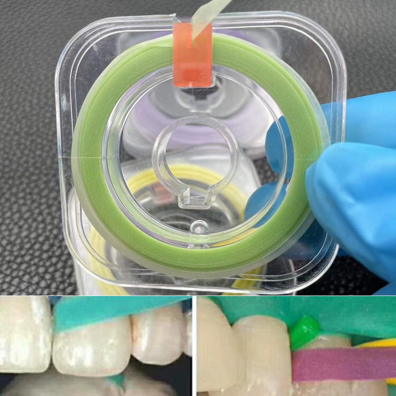 Dental Teeth nterproxmal Polshng Strp Polsher Sandng Grndng 6m