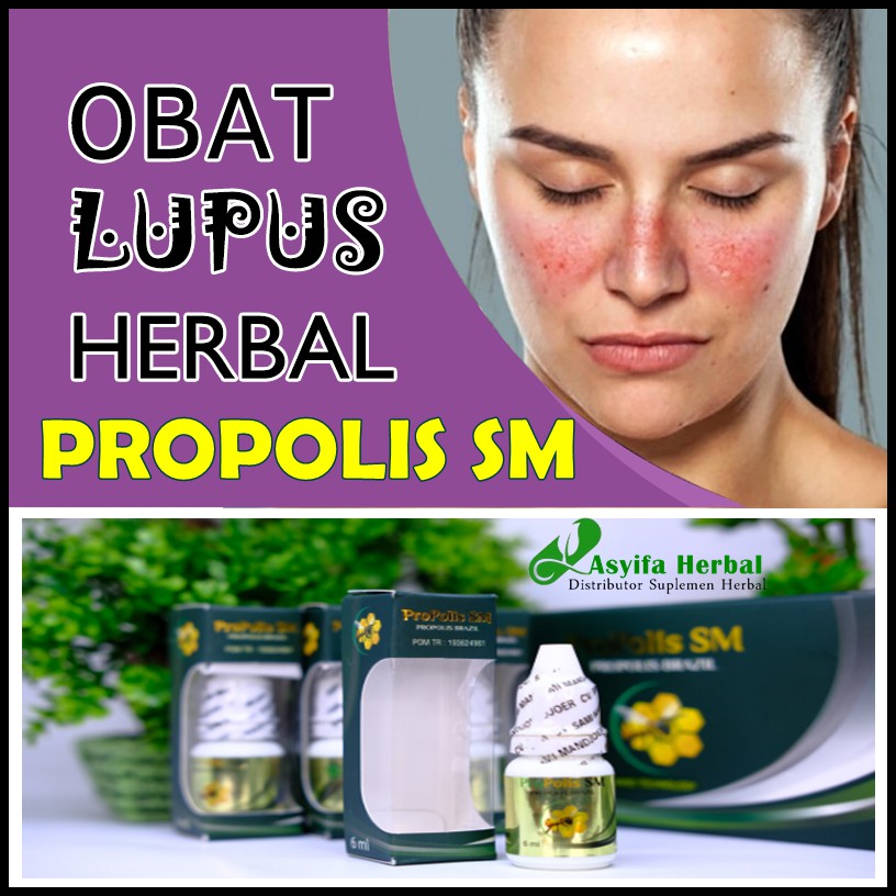 Lupus Medication, Lupus Medication Autoimun, Joint Pain And Joints