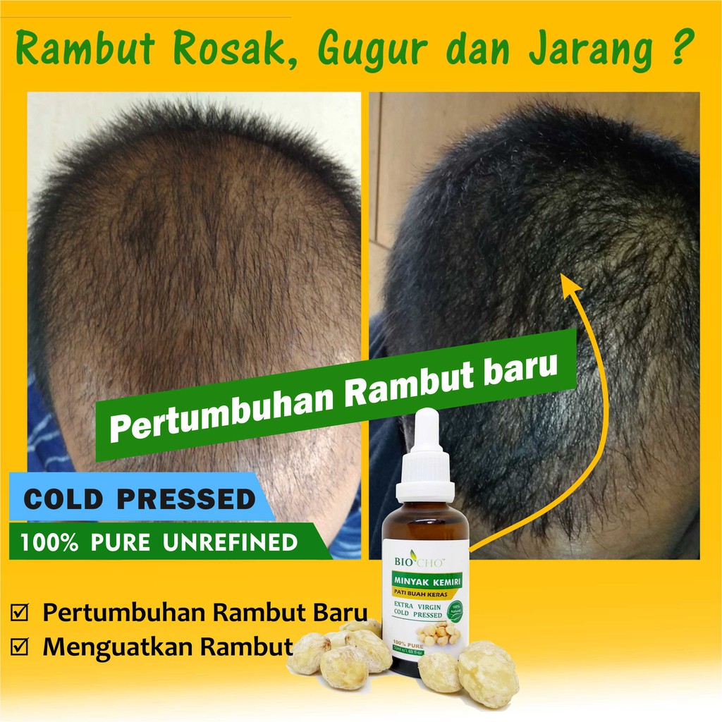 [Local] Biocho Minyak Buah Keras 100% Asli Lebatkan Rambut Lelaki Hair ...