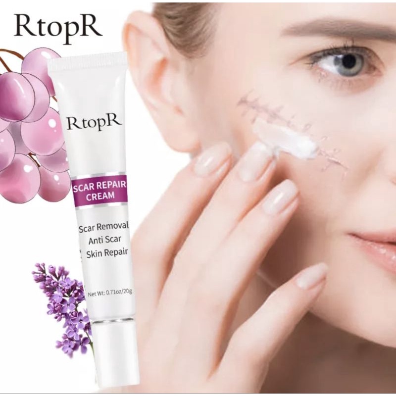 RtopR Scar Repair Cream 20g | 疤痕修复霜 | Shopee Malaysia