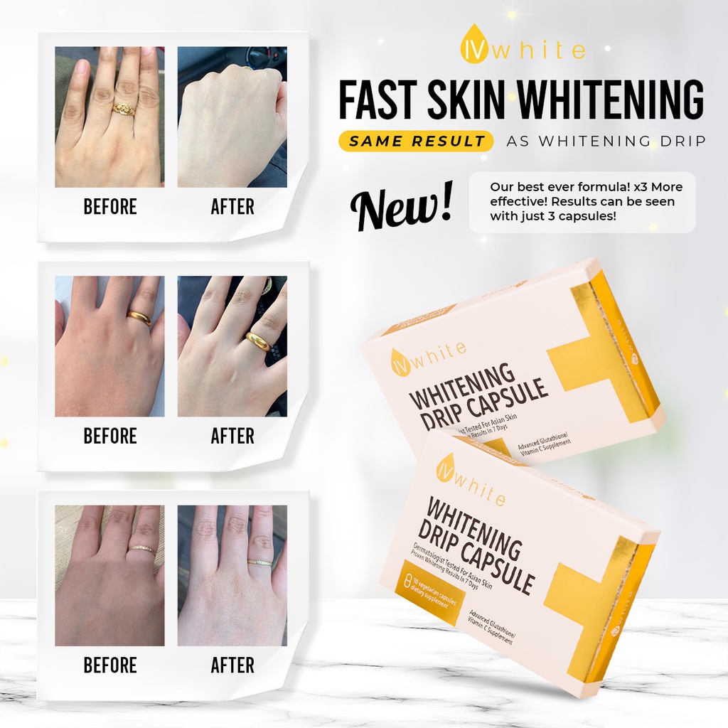 IvWhite KOREA Whitening Drip Capsule Supplement (HIGHLY EFFECTIVE