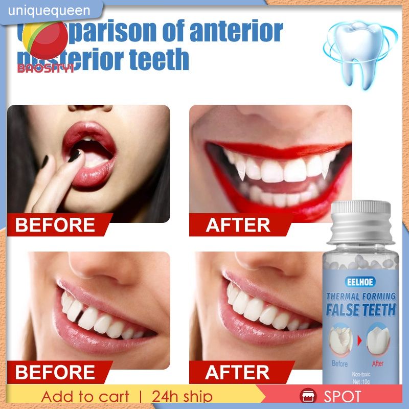 EELHOE Denture Solid Glue Whitening Tooth Temporary Repair Kit Teeth