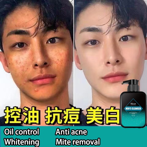 Pencuci Muka Eucerin Pro Acne – Berkesan Untuk Jerawat Hormonal?