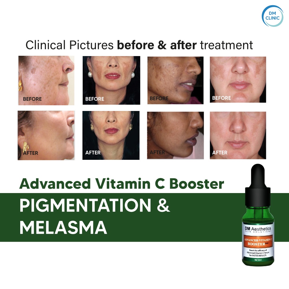 DM Aesthetics Advanced Vitamin C Booster Serum Hyaluronic Acid