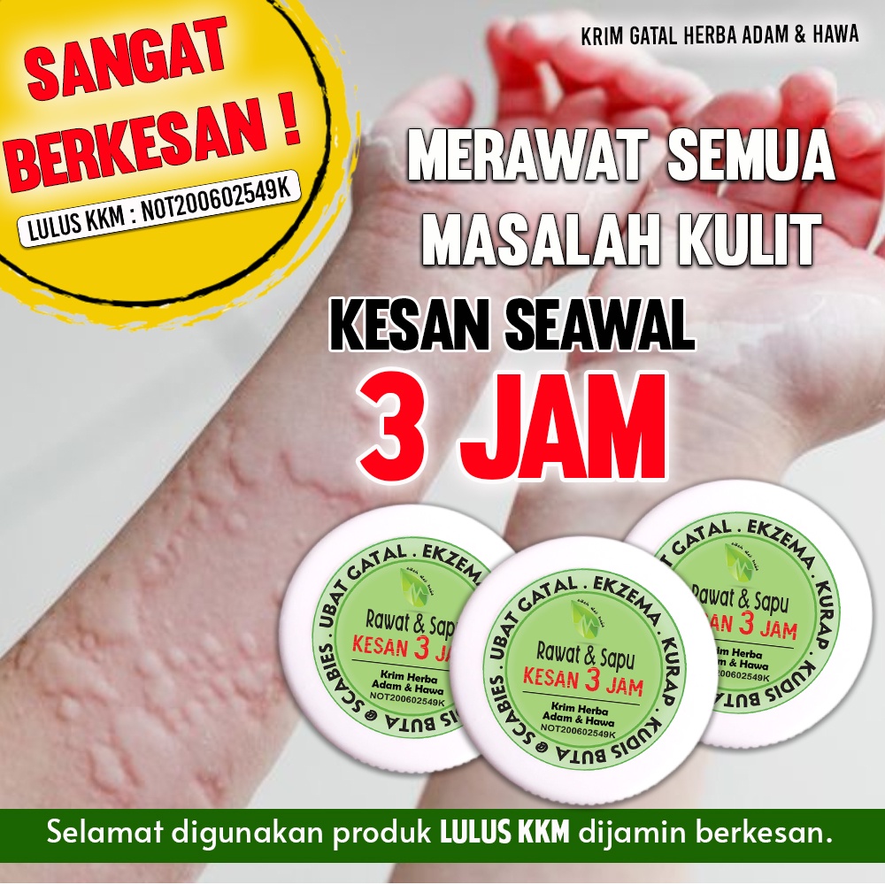 Krim Kurap Kudis Psiorasis Ekzema Panau Fungus Gatal Cream Eczema