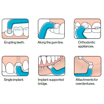 Tepe Compact Tuft Single Tufted Special Soft Toothbrush For Braces 