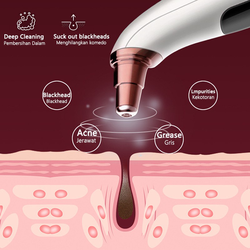 🔥【ready stock】🔥 Blackhead Remover Facial Skin Cleanser Vacuum Suction ...