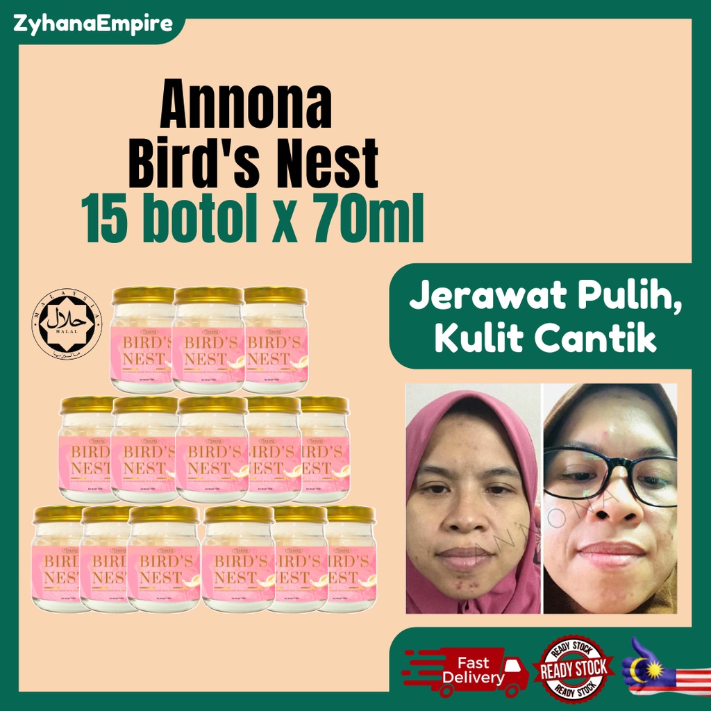 Minuman Sarang Burung Halal Supplement Kulit Jerawat Bird Nest Beauty