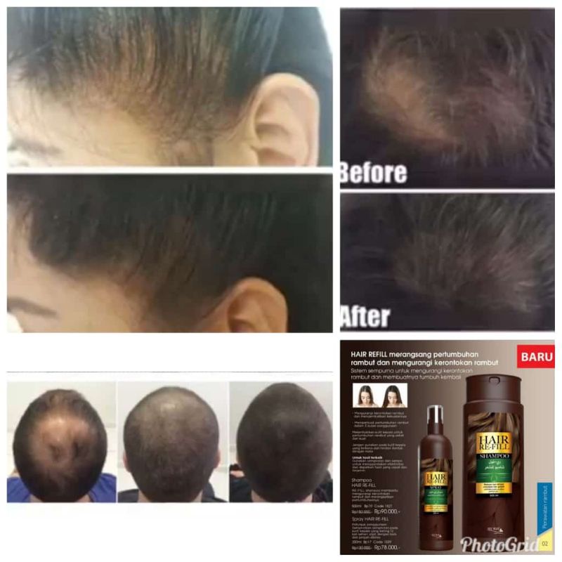 SAMPO Anti Loss Shampoo / anti Bald original import MyWay Refill ...