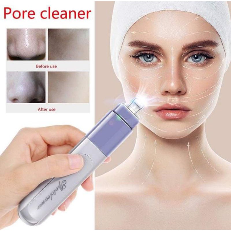 Ready Stock Remover Vacuum Facial Pore Cleanser Acne Comedone Extractor Kit Blackhead Shopee 4786