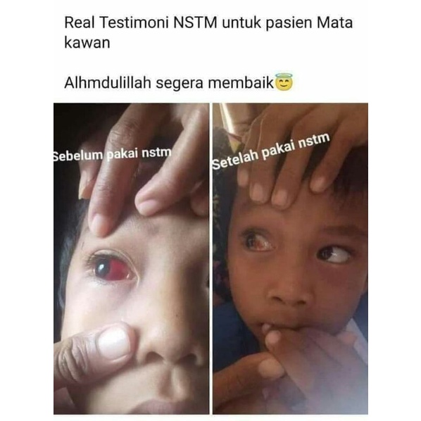 MERAH MATA Herbal Drops Heal Red Eyes Heavy Irritation/ MEN, PLUSE