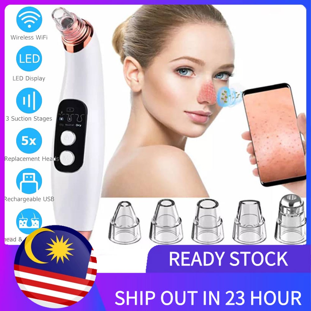 🔥STOCK READY🔥Vroom Blackhead Suction Vacuum Acne facial whitehead