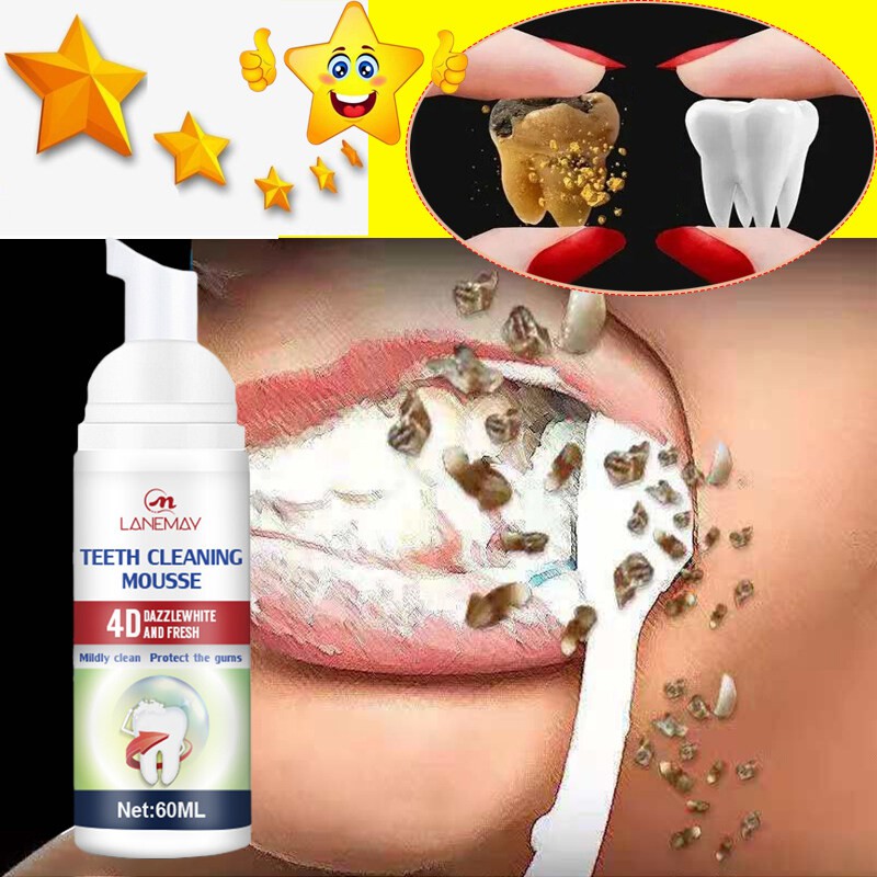 Teeth whitening mousse toothpaste Remove stone tartar plaque tobacco ...