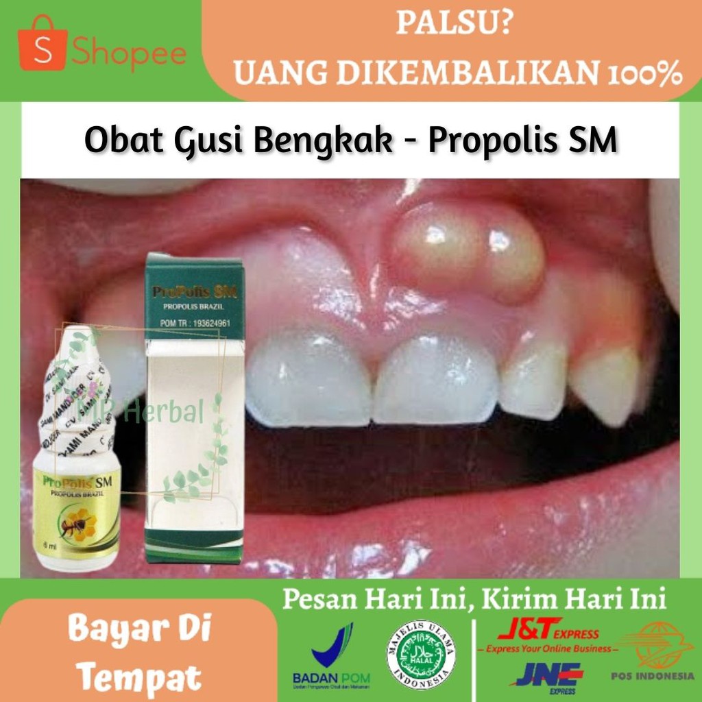 SM Swelling Gum Medicine, Swelling Gum Medicine, Swelling Gum Medicine