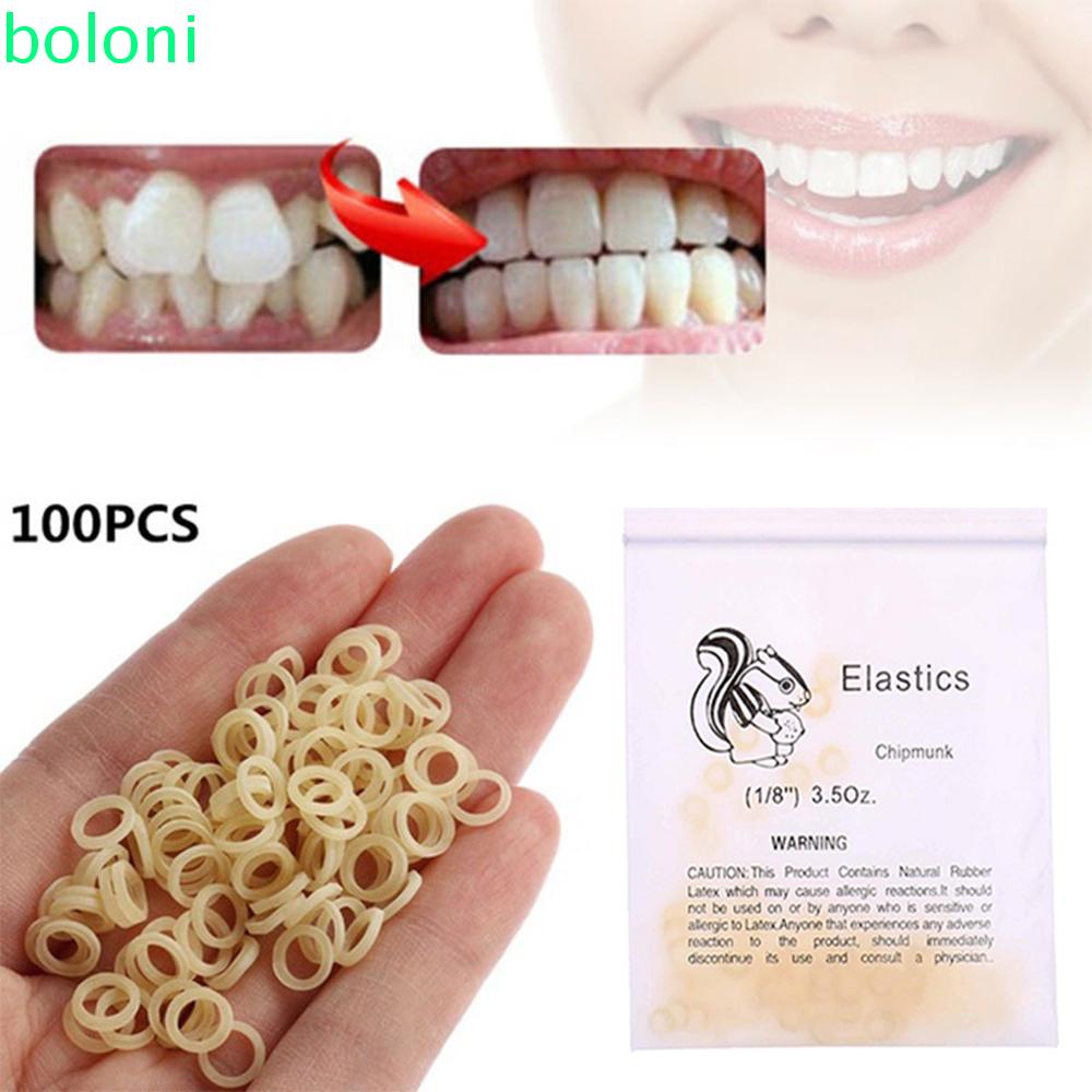 [COD] Teeth Stain Removal Dental Orthodontic Rings Tooth Care Ligation