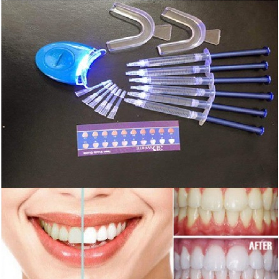 Oral Hygiene Tooth Whitener Bleaching Teeth White Teeth Whitening Kit