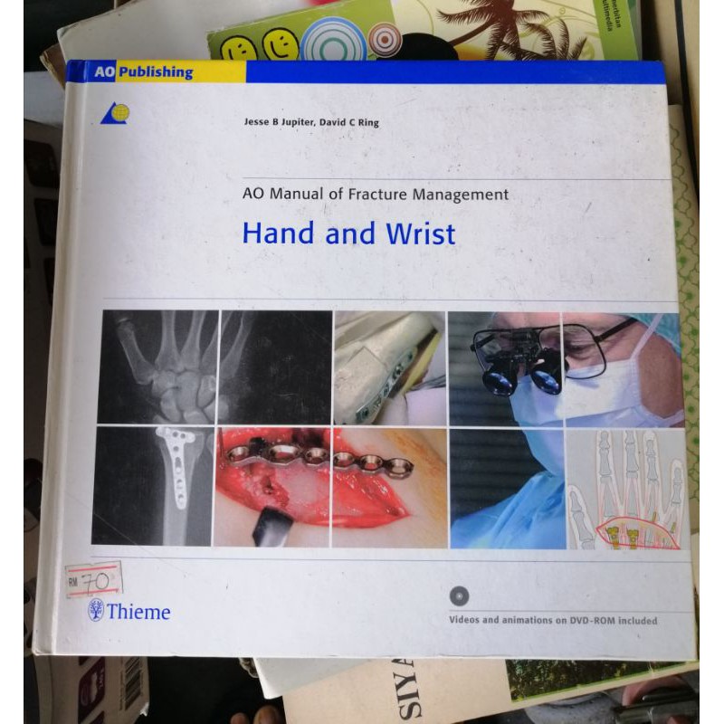 AO Manual of Fracture Management (Hand and Wrist) | Shopee Malaysia