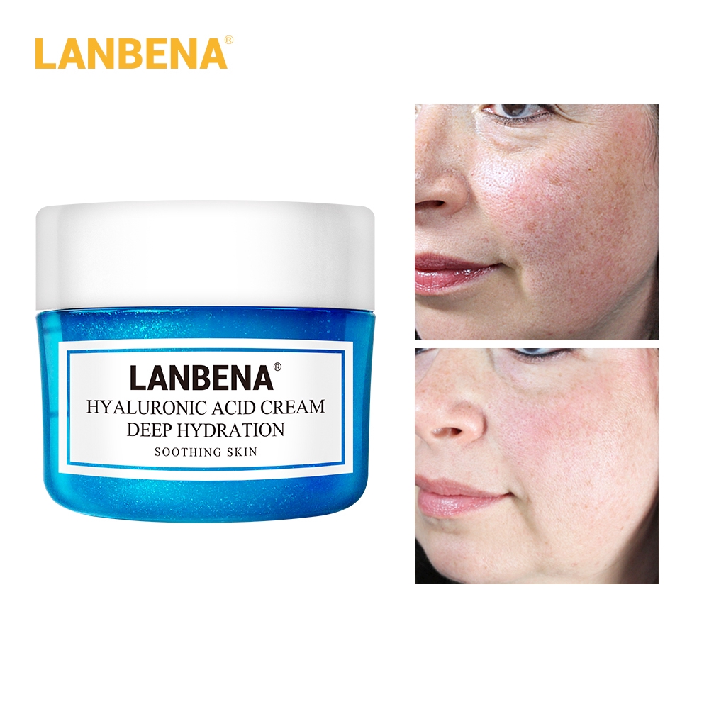 LANBENA Hyaluronic Acid Face Cream Skin Whitening Facial Cream Dark