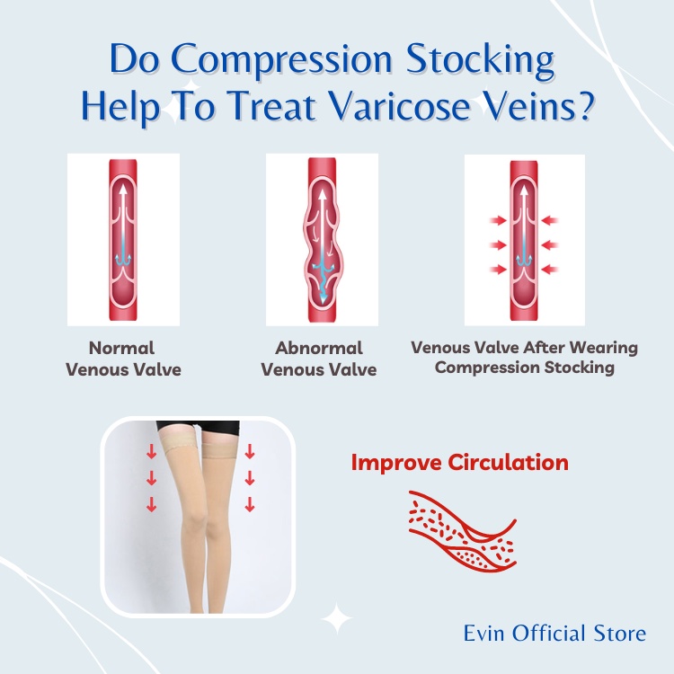 EVIN Compression Socks 15-20mmHg Thigh High Open Toe | Stoking Urat ...