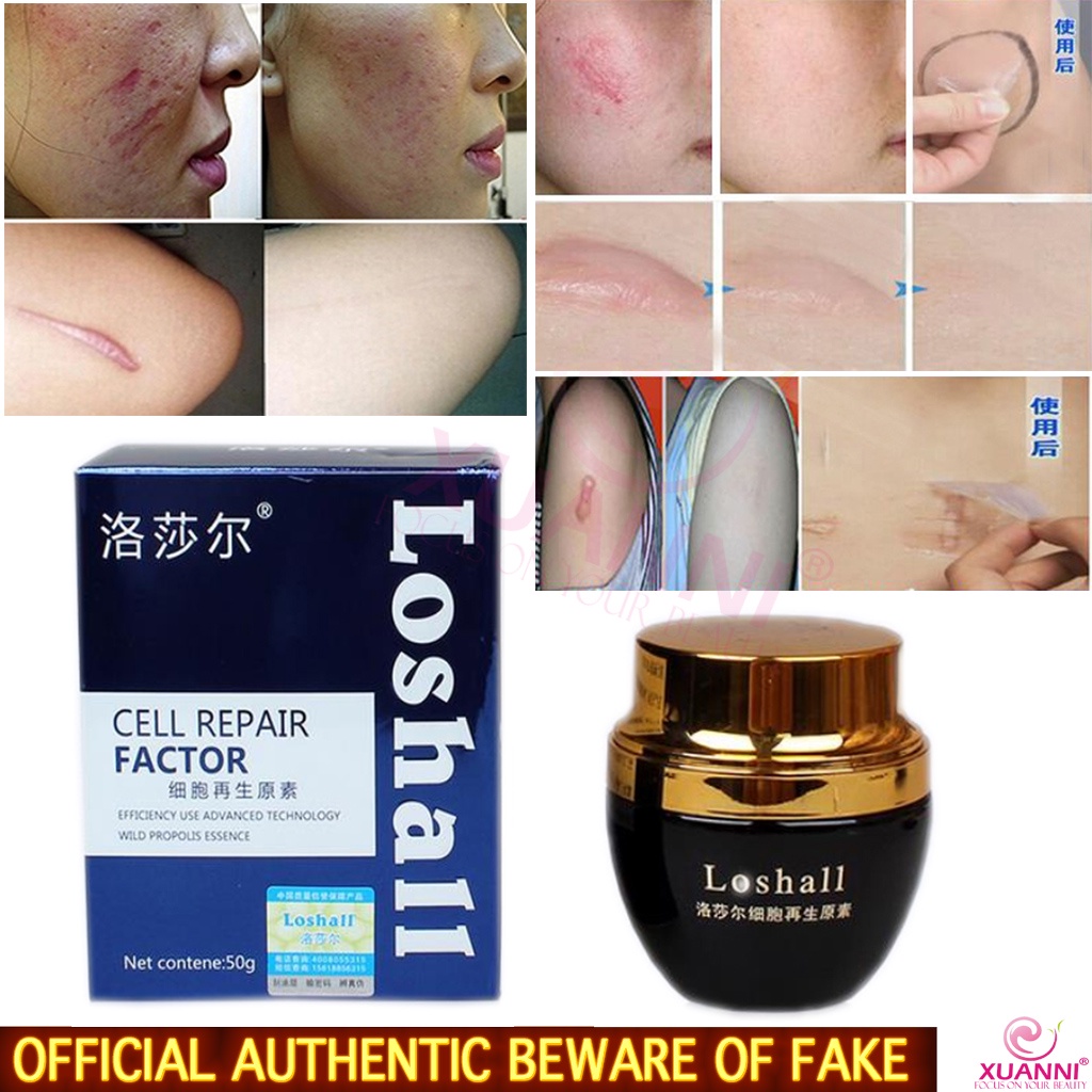 ORIGINAL IMPORT LOSHALL CELL REPAIR FACTOR SURGERY SCAR REPAIR PEEL ...