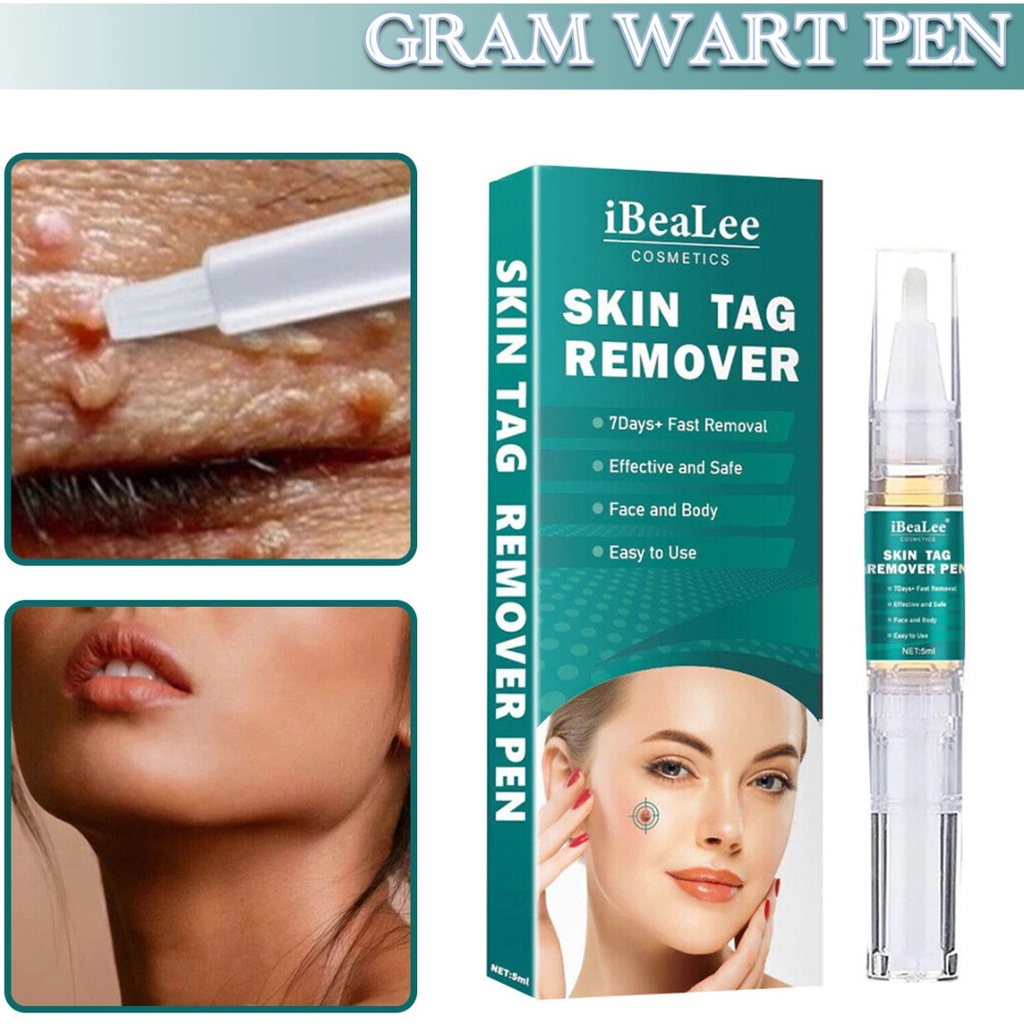 Skin Tag Remover Pen 5ml Natural Beauty Face Moles Warts Removal Liquid ...